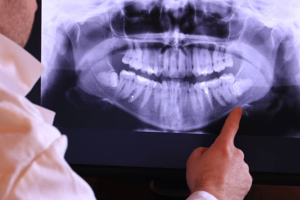 Best Emergency Dental Extractions in New Market, MD