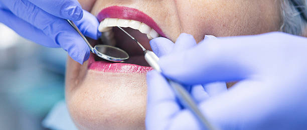Best Emergency Root Canal Treatment in New Market, MD